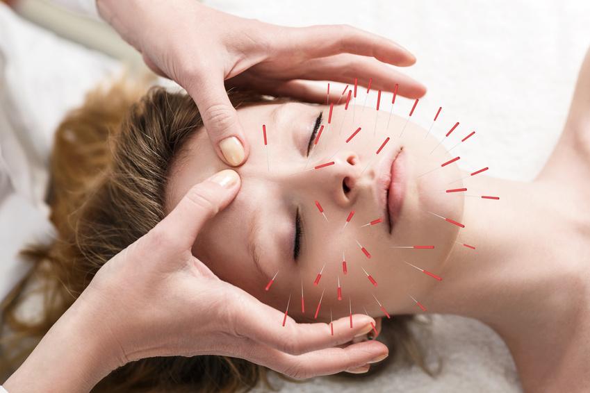 Praktische Empfehlungen zur Integration von Akupunktur in die Schmerztherapie: Tipps für Patienten und Therapeuten